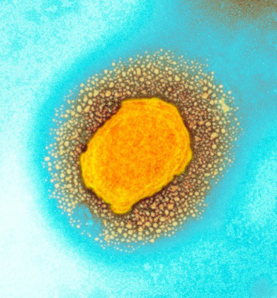 猴痘病毒（见彩色透射电子显微照片）