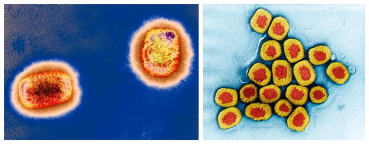  猴痘病毒颗粒，来源：英国《新科学家》杂志网站                 天花病毒颗粒，来源：中国《显微镜下的疾病与药物》